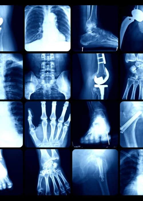 X-ray Machine